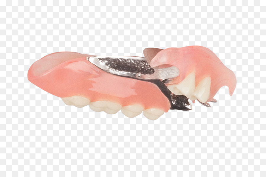 أطقم الأسنان الجزئية القابلة للإزالة，أطقم الأسنان PNG