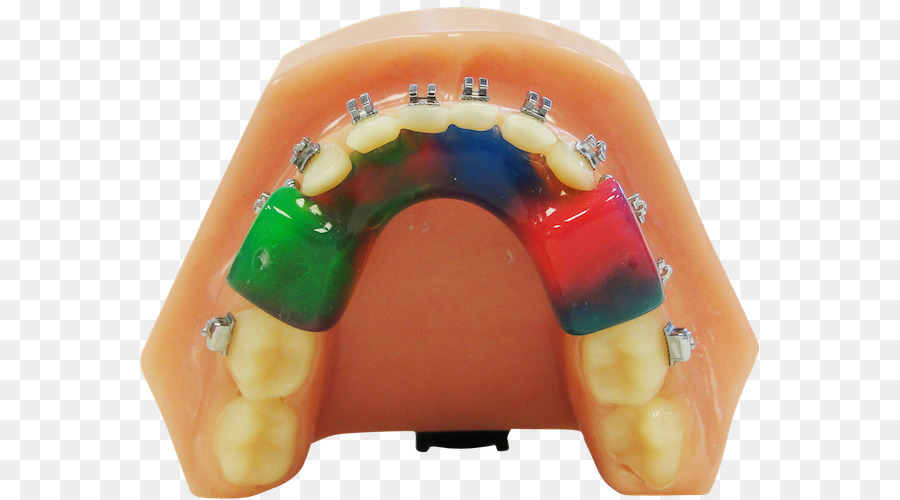 الأسنان，التوأم كتلة الأجهزة PNG