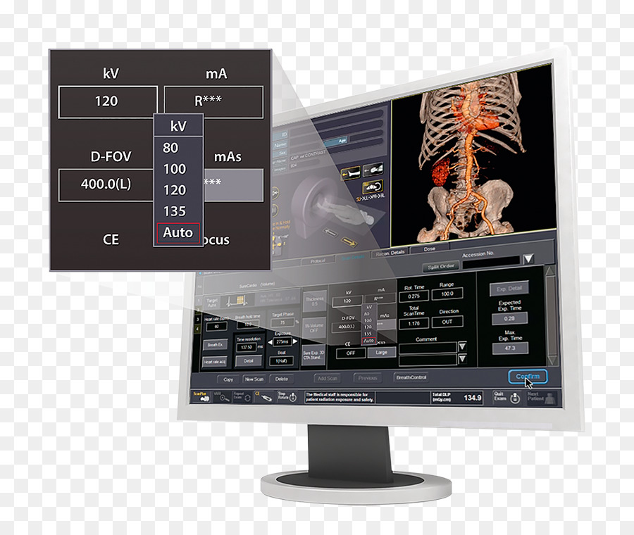 شاشات الكمبيوتر，Canon Medical Systems Corporation PNG