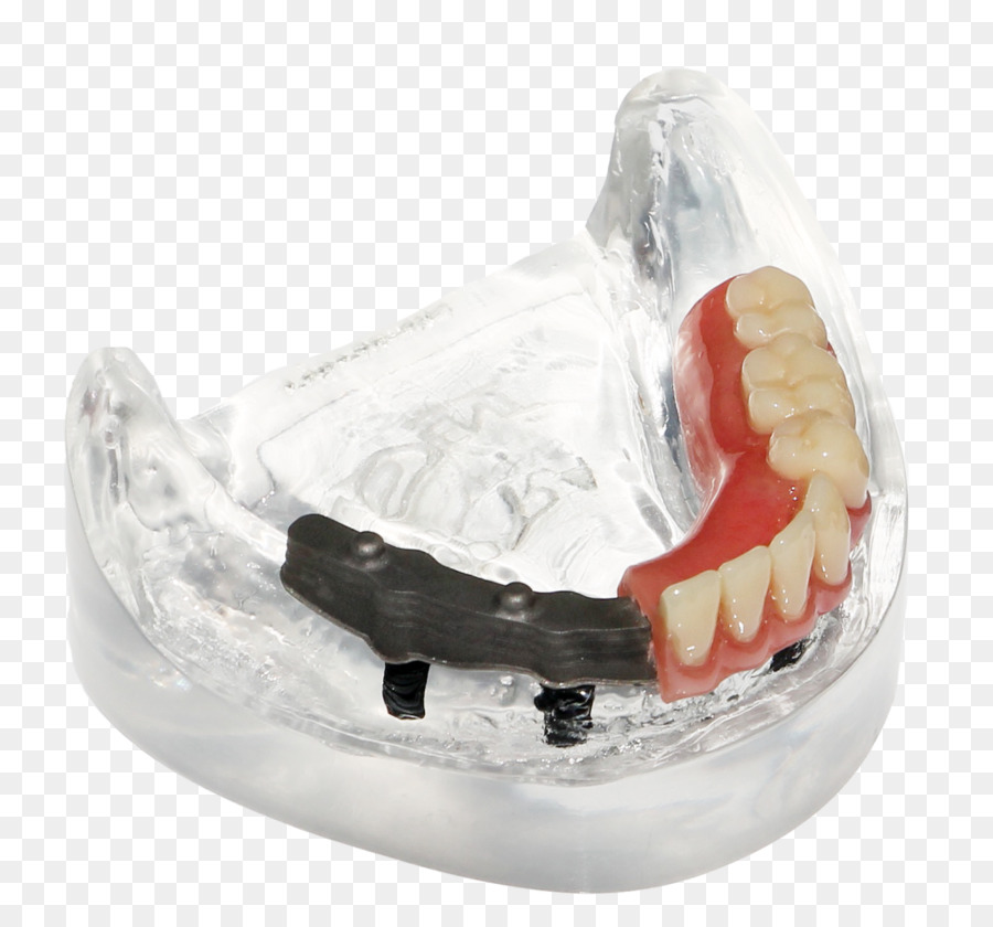 أطقم الأسنان，الاصطناعية PNG
