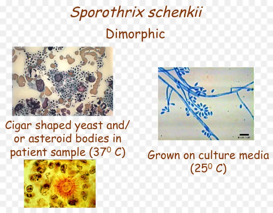 Sporothrix Schenckii，خميرة PNG