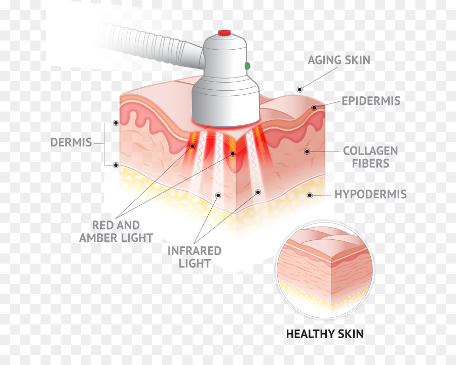 علاج الجلد，الضوء الأحمر PNG
