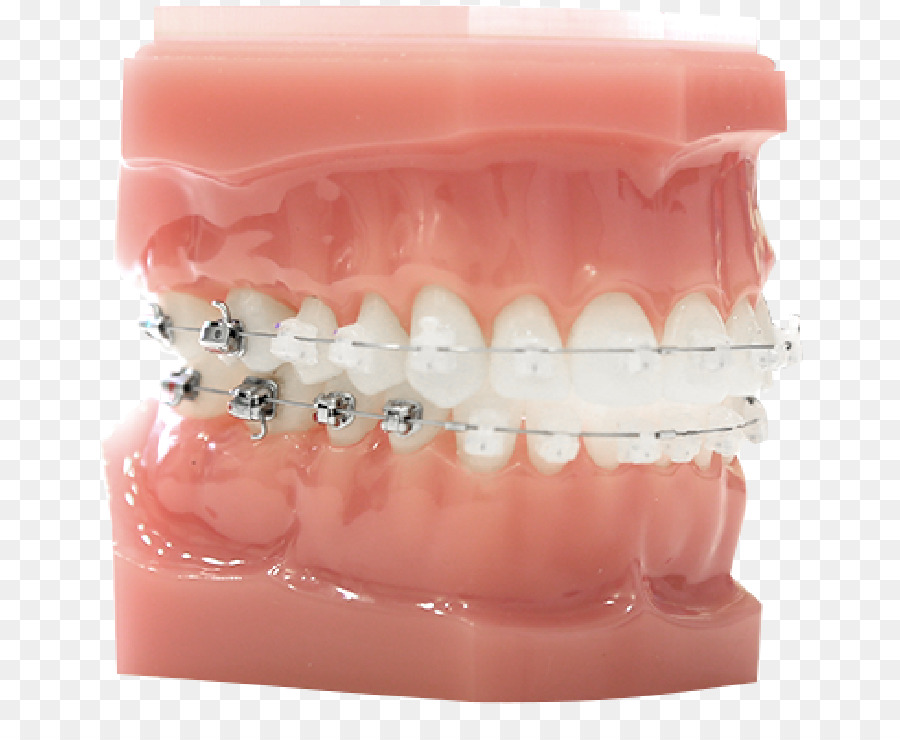 الأسنان，نظام ديمون PNG