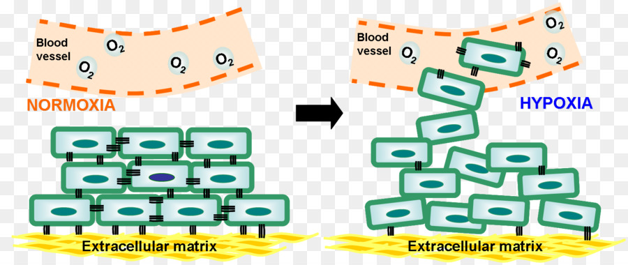 نقص الأكسجة，نقص الأكسجة السرطان البيولوجي الآثار العلاجية الفرص PNG