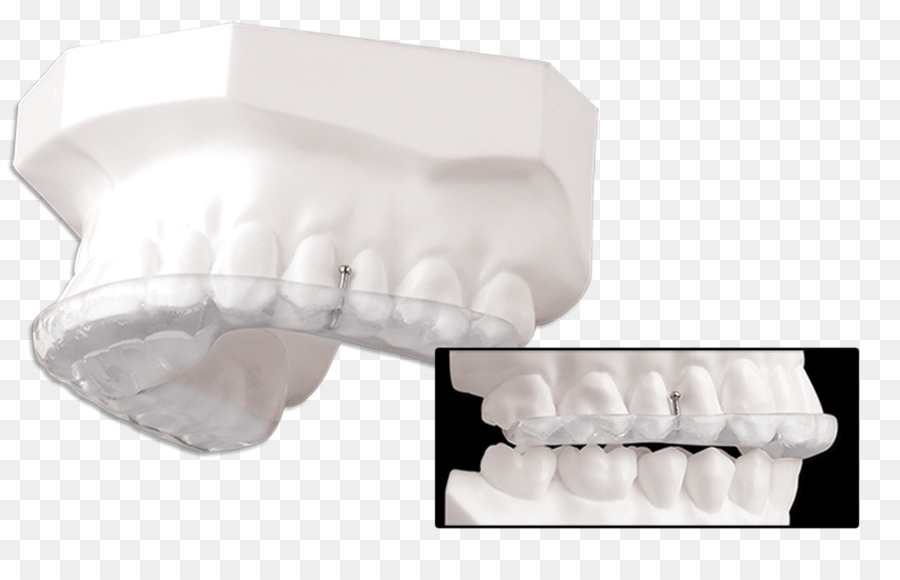 جبيرة，الأسنان PNG